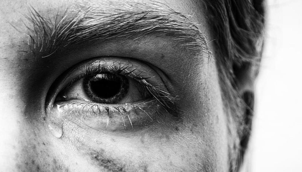 علاج فرط الدموع