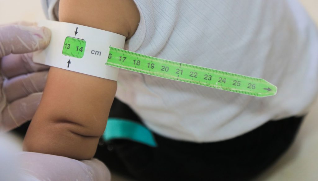 علاج سوء التغذية و متابعة نمو الطفل