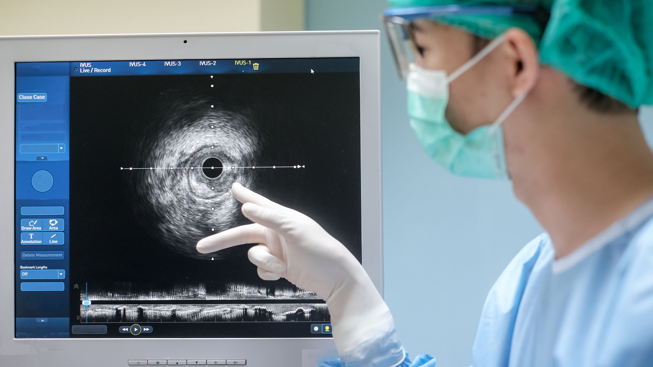 فهم-جراحة-صمامات-المخ-والقسطرة-المخية