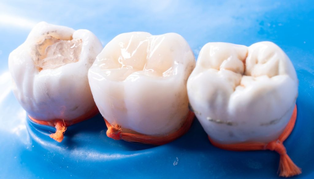 حشو الأسنان