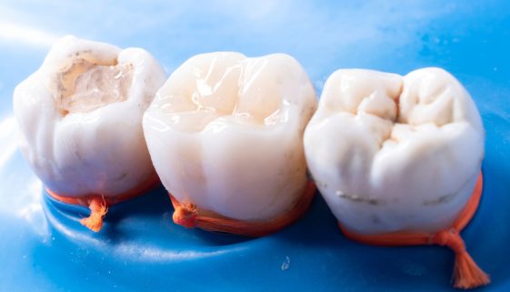 حشو الأسنان