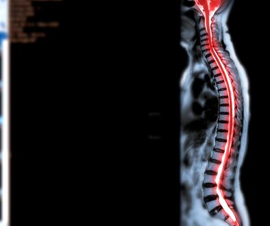 جراحة النخاع الشوكي