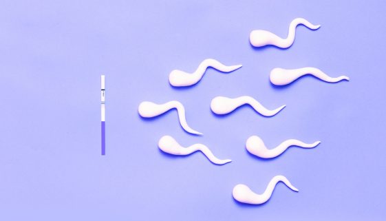 علاج حالات إنعدام الحيوانات المنوية